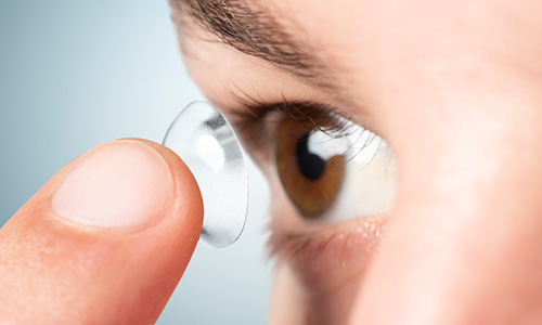 Scleral Lens